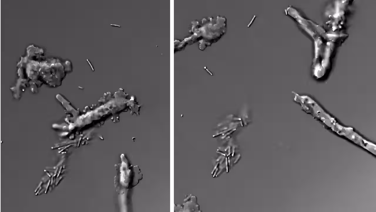 "Fire Amoeba" Sets New Heat Record for Complex Cells, Reproducing at 63°C
